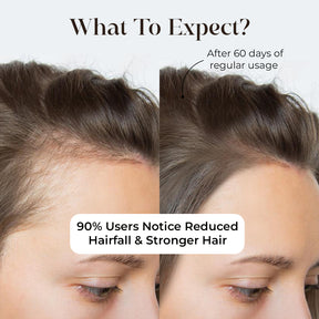 gummy hair, biotin gummies for hair,
biotin gummies, hair growth gummies, hair gummies,
hair gummies for women,
multivitamin gummies, biotin hair gummies, skin gummies, gummies for hair and skin, vitamin gummies